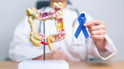 Ce signe banal que beaucoup ont déjà ressenti peut annoncer un cancer colorectal selon ce médecin