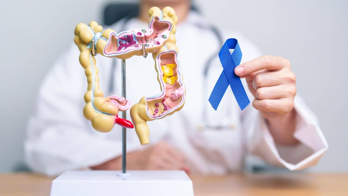 Ce signe banal que beaucoup ont déjà ressenti peut annoncer un cancer colorectal selon ce médecin